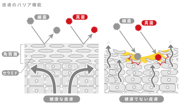 皮膚のバリア機能